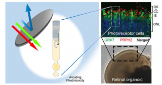 Limiting certain light exposure has the potential to prevent inherited retinal dystrophy