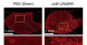 Nanotechnology for genome editing in multiple muscles simultaneously