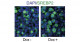 ALS-related protein TDP-43 regulates cholesterol synthesis ~Insight for molecular mechanisms of lipid metabolism and nutritional therapy in ALS~