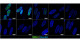 Reproducing skeletal muscle pathology of myotonic dystrophy using patient-derived iPS cells and establishing a new system to quantitatively evaluate drug efficacy