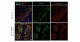 デュシェンヌ型筋ジストロフィー（DMD）に対する細胞治療研究の非臨床試験に向けた免疫不全DMDモデルラットの確立