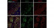 Creating a rat model for testing cell therapy in Duchenne muscular dystrophy