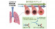 COVID-19が重症化する人は血液の代謝産物組成が異なる―感染初期での重症化リスクの予測マーカーを同定―