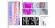 Inhibition of oxidative phosphorylation points to a new potential treatment fo