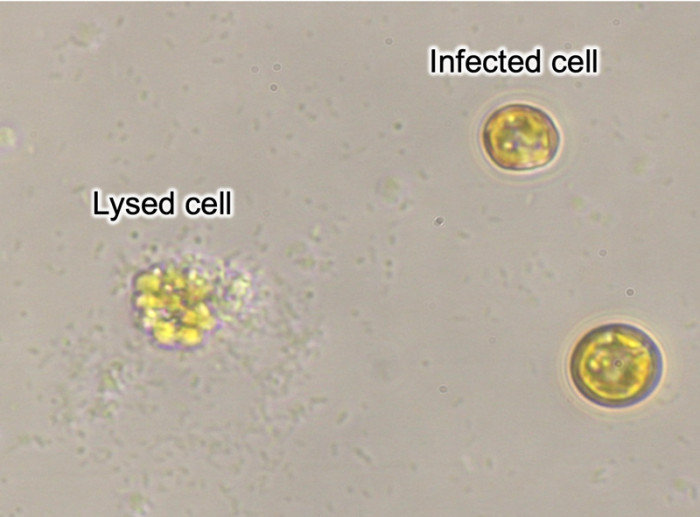 2609-main-endo_phytoplankton-cells.jpg